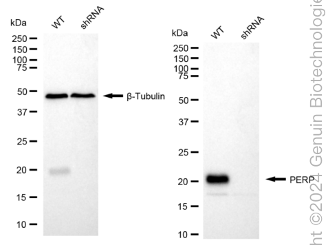KD-Validated Anti-PERP Rabbit Monoclonal Antibody ABG1697