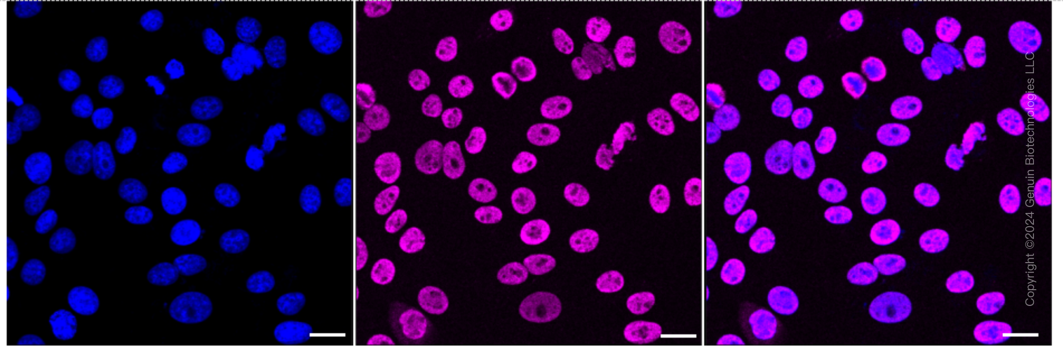 KD-Validated Anti-TAF15 Rabbit Monoclonal Antibody ABG1701