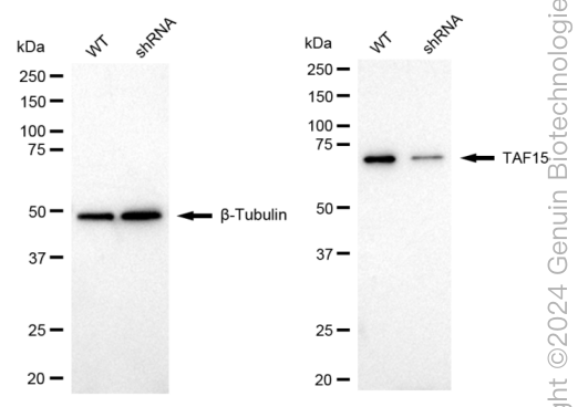 KD-Validated Anti-TAF15 Rabbit Monoclonal Antibody ABG1701