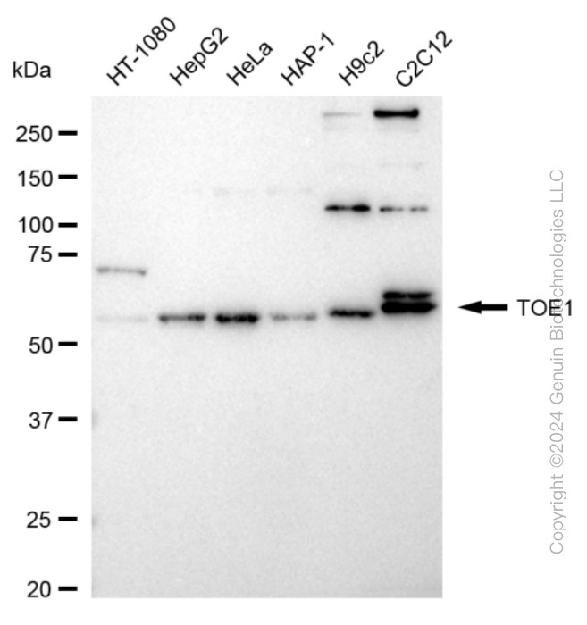 KD-Validated Anti-TOE1 Rabbit Monoclonal Antibody ABG1702