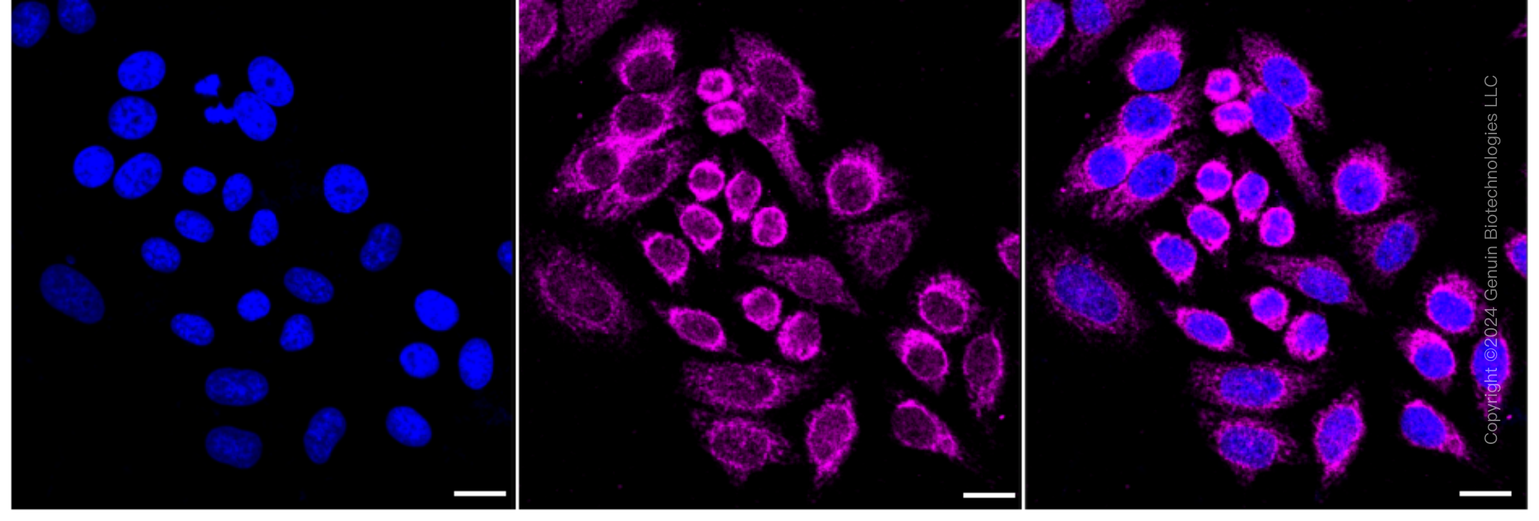 KD-Validated Anti-Stomatin Like 2 Rabbit Monoclonal Antibody ABG1703