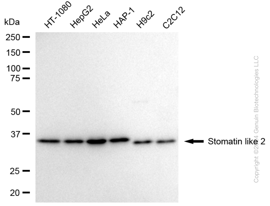 KD-Validated Anti-Stomatin Like 2 Rabbit Monoclonal Antibody ABG1703