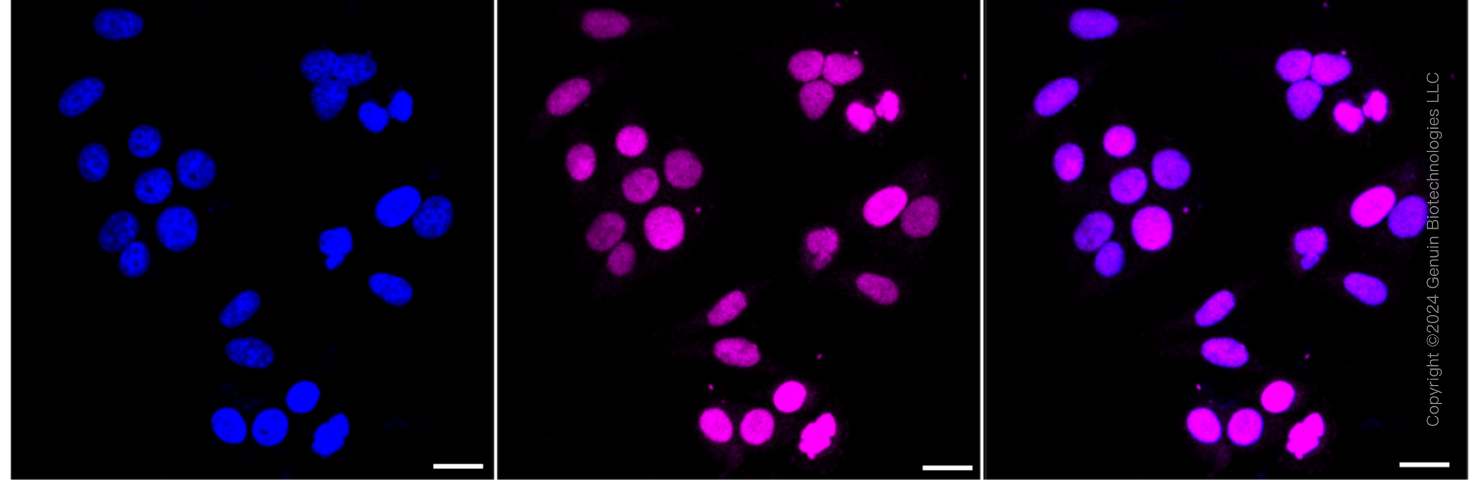 KD-Validated Anti-Topoisomerase II alpha Rabbit Monoclonal Antibody ABG1704