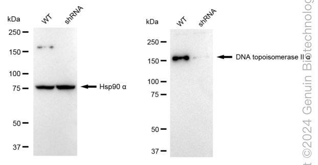 KD-Validated Anti-Topoisomerase II alpha Rabbit Monoclonal Antibody ABG1704