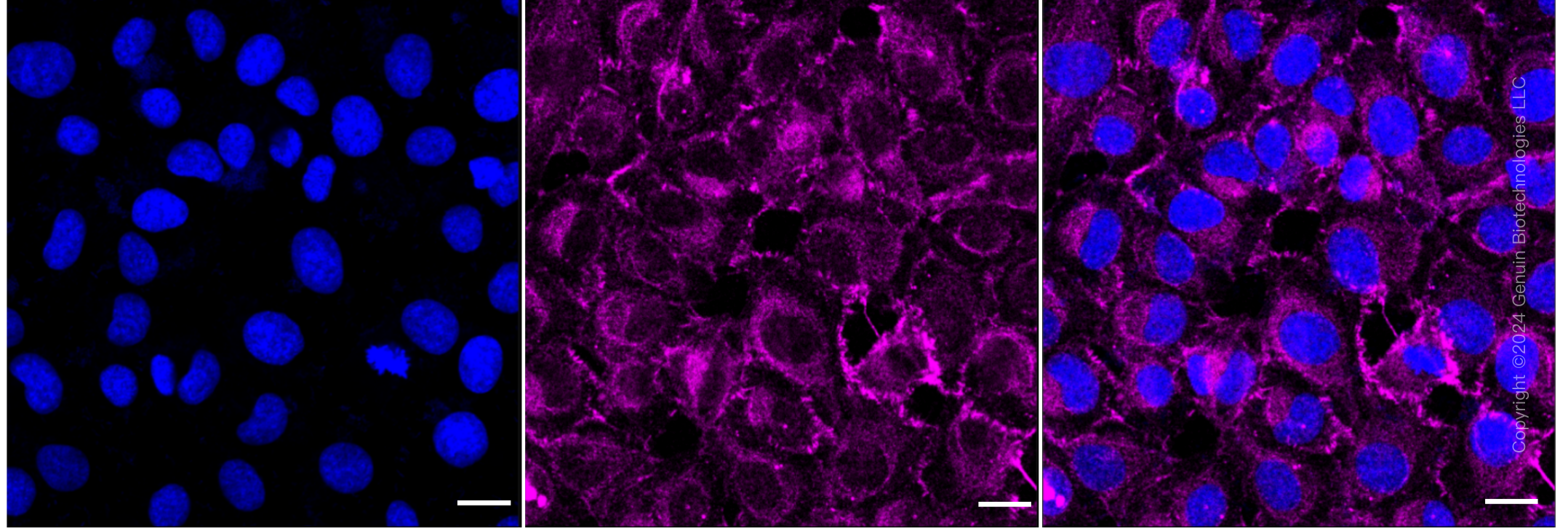 KD-Validated Anti-Transcription Factor 7 Like 1 Rabbit Monoclonal Antibody ABG1706