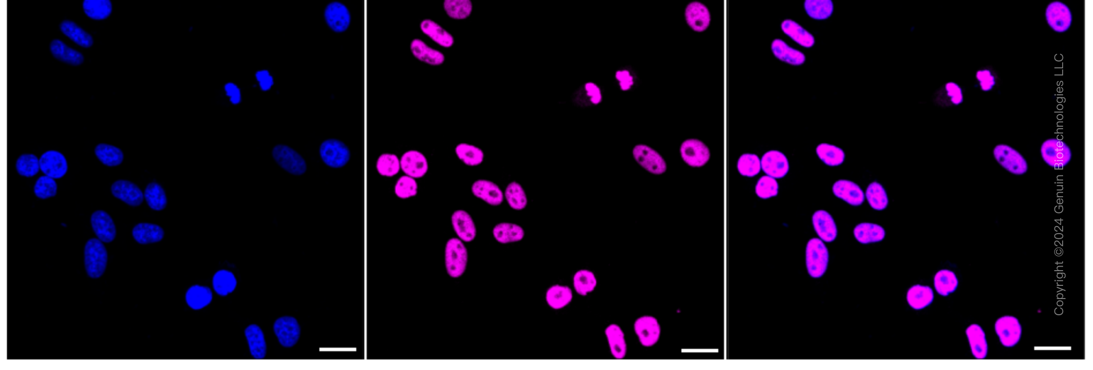 KD-Validated Anti-SMARCA4 Rabbit Monoclonal Antibody ABG1707