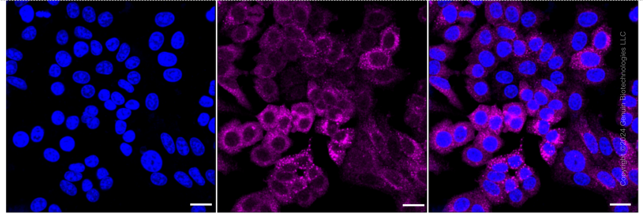 KD-Validated Anti-TRK fused gene Rabbit Monoclonal Antibody ABG1709