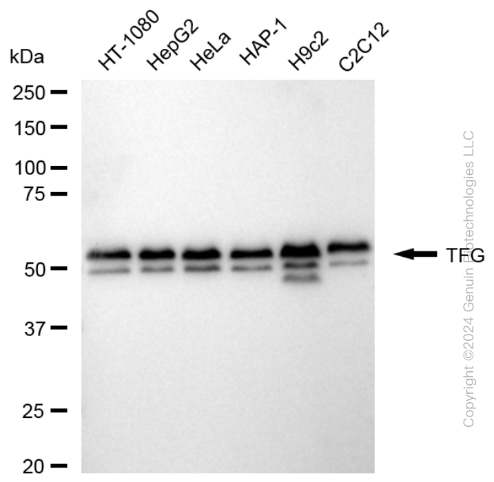 KD-Validated Anti-TRK fused gene Rabbit Monoclonal Antibody ABG1709