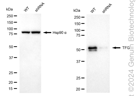 KD-Validated Anti-TRK fused gene Rabbit Monoclonal Antibody ABG1709
