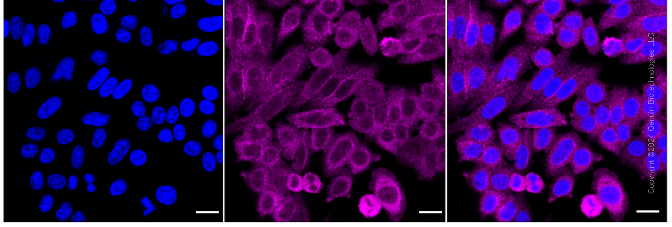 KD-Validated Anti-Ubiquitin Specific Peptidase 14 Rabbit Monoclonal Antibody ABG1710
