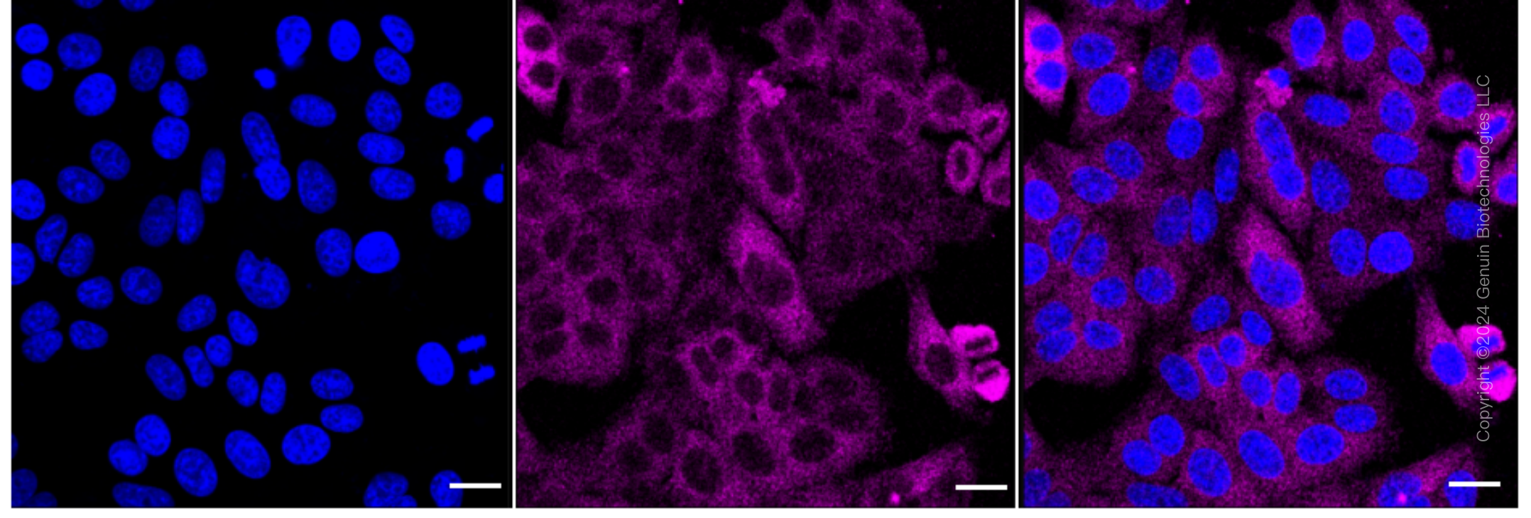 KD-Validated Anti-TRPM7 Rabbit Monoclonal Antibody ABG1712