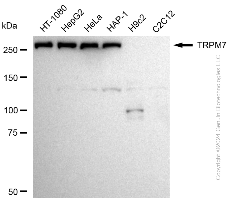 KD-Validated Anti-TRPM7 Rabbit Monoclonal Antibody ABG1712