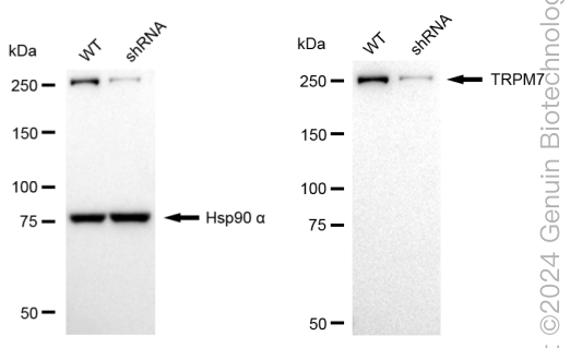 KD-Validated Anti-TRPM7 Rabbit Monoclonal Antibody ABG1712