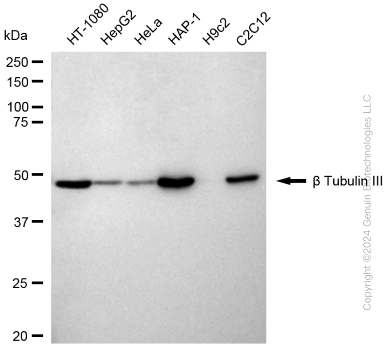 KD-Validated Anti-Tubulin Beta 3 Class III Rabbit Monoclonal Antibody ABG1713