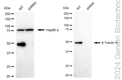 KD-Validated Anti-Tubulin Beta 3 Class III Rabbit Monoclonal Antibody ABG1713