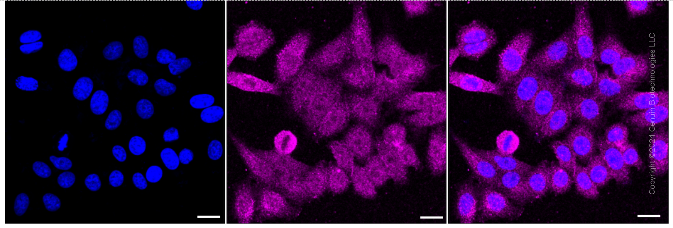 KD-Validated Anti-Vascular Endothelial Growth Factor D Rabbit Monoclonal Antibody ABG1714