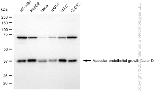 KD-Validated Anti-Vascular Endothelial Growth Factor D Rabbit Monoclonal Antibody ABG1714