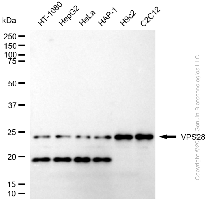 KD-Validated Anti-VPS28 Subunit Of ESCRT-I Rabbit Monoclonal Antibody ABG1715