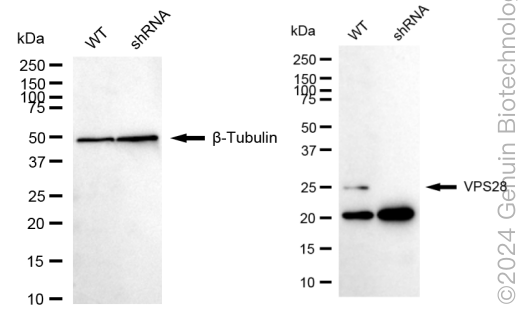 KD-Validated Anti-VPS28 Subunit Of ESCRT-I Rabbit Monoclonal Antibody ABG1715