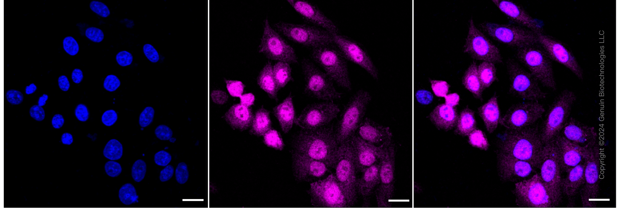KD-Validated Anti-Ubiquitination Factor E4B Rabbit Monoclonal Antibody ABG1716