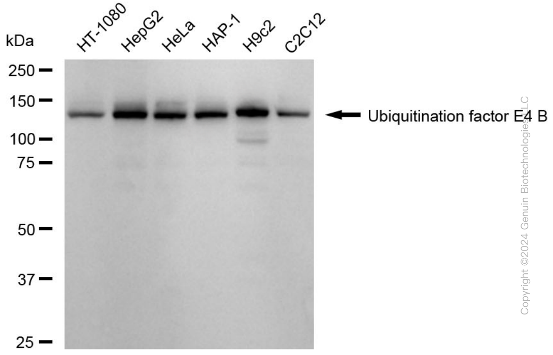 KD-Validated Anti-Ubiquitination Factor E4B Rabbit Monoclonal Antibody ABG1716