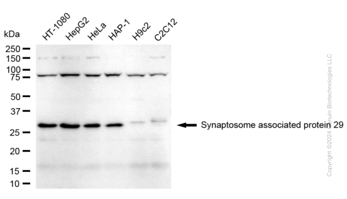 KD-Validated Anti-Synaptosome Associated Protein 29 Rabbit Monoclonal Antibody ABG1718