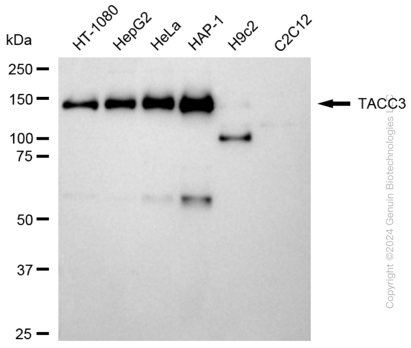KD-Validated Anti-TACC3 Rabbit Monoclonal Antibody ABG1720