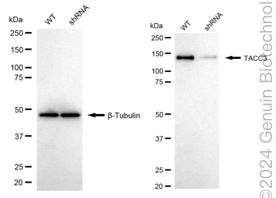 KD-Validated Anti-TACC3 Rabbit Monoclonal Antibody ABG1720