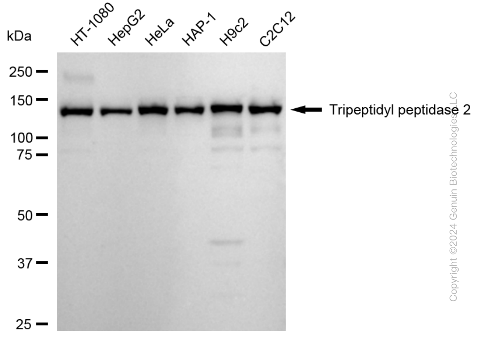 KD-Validated Anti-Tripeptidyl peptidase 2 Rabbit Monoclonal Antibody ABG1721