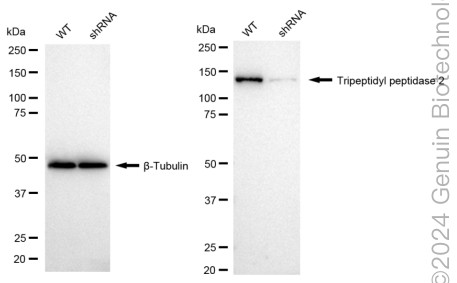 KD-Validated Anti-Tripeptidyl peptidase 2 Rabbit Monoclonal Antibody ABG1721