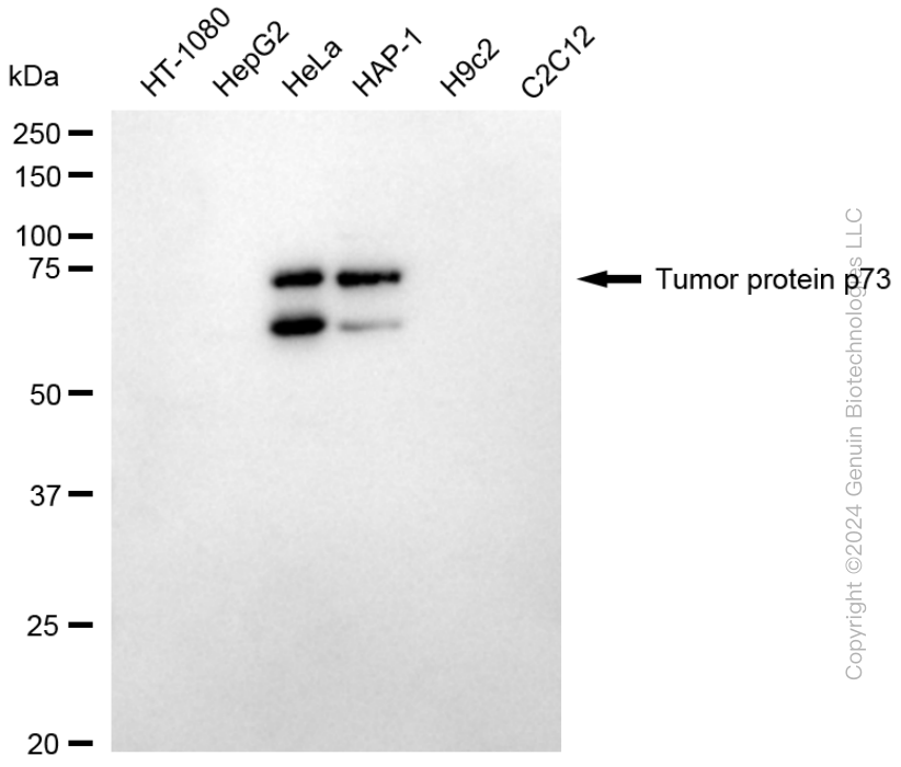 KD-Validated Anti-Tumor Protein P73 Rabbit Monoclonal Antibody ABG1722