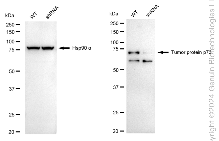 KD-Validated Anti-Tumor Protein P73 Rabbit Monoclonal Antibody ABG1722