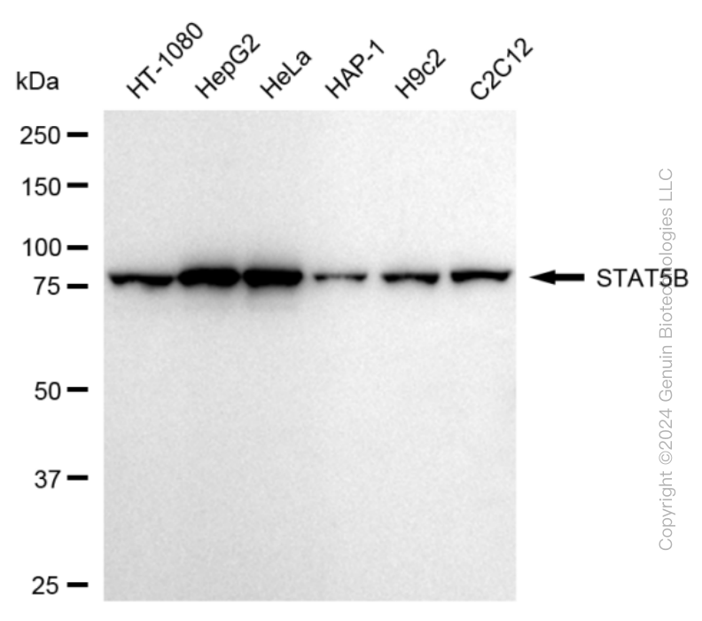 KD-Validated Anti-STAT5B Rabbit Monoclonal Antibody ABG1724