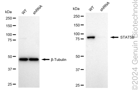 KD-Validated Anti-STAT5B Rabbit Monoclonal Antibody ABG1724