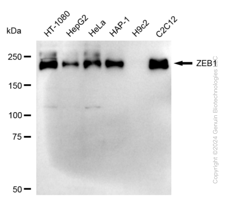 KD-Validated Anti-Zinc Finger E-Box Binding Homeobox 1 Rabbit Monoclonal Antibody ABG1725