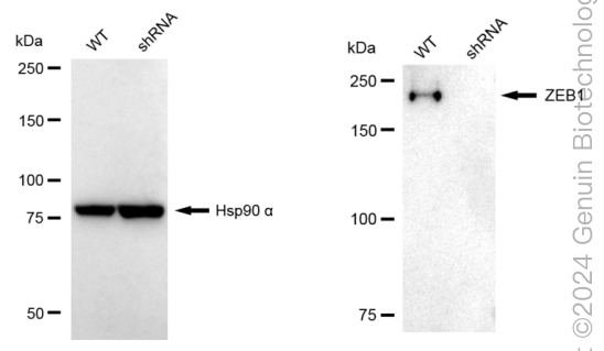 KD-Validated Anti-Zinc Finger E-Box Binding Homeobox 1 Rabbit Monoclonal Antibody ABG1725