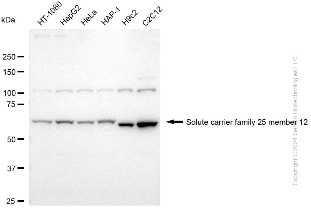 KD-Validated Anti-SLC25A12 Rabbit Monoclonal Antibody ABG1727