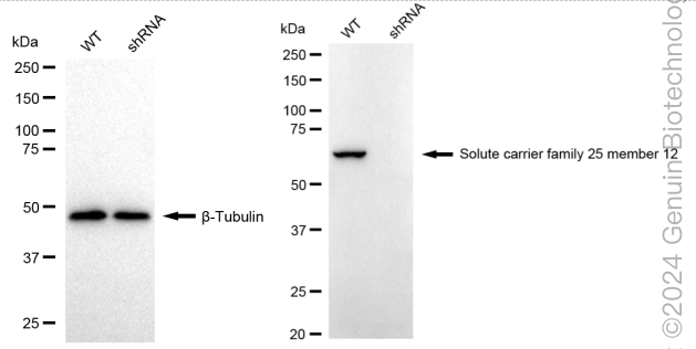 KD-Validated Anti-SLC25A12 Rabbit Monoclonal Antibody ABG1727