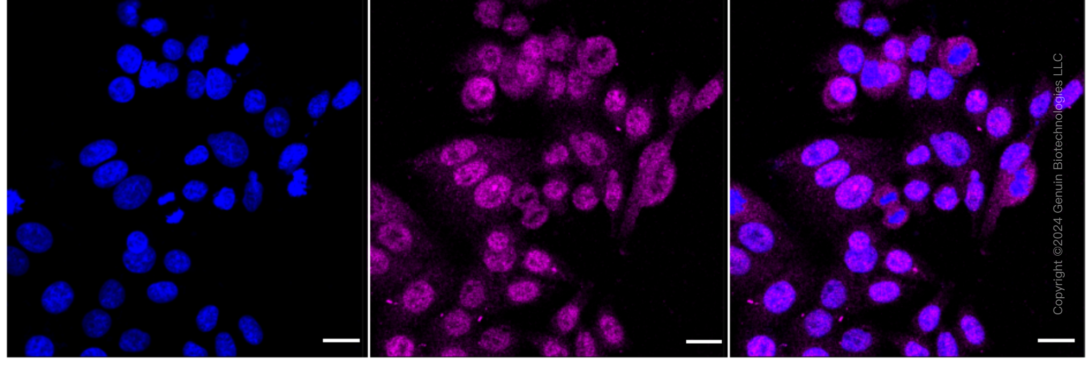 KD-Validated Anti-Serine Racemase Rabbit Monoclonal Antibody ABG1728