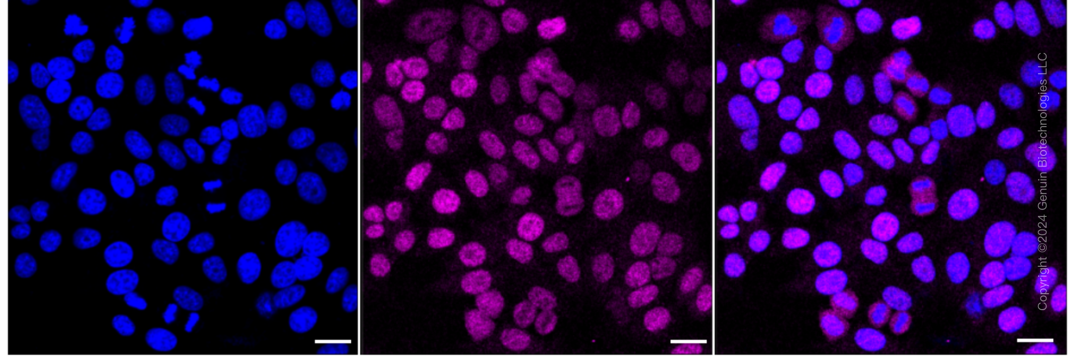 KD-Validated Anti-UBE2T Rabbit Monoclonal Antibody ABG1729