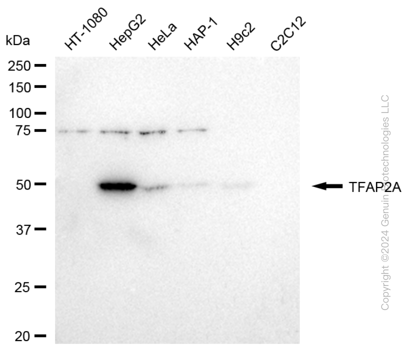 KD-Validated Anti-TFAP2A Rabbit Monoclonal Antibody ABG1731