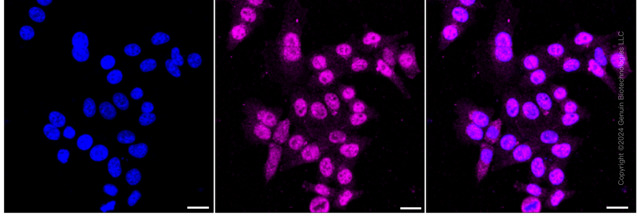 KD-Validated Anti-Tropomyosin 1 Rabbit Monoclonal Antibody ABG1732