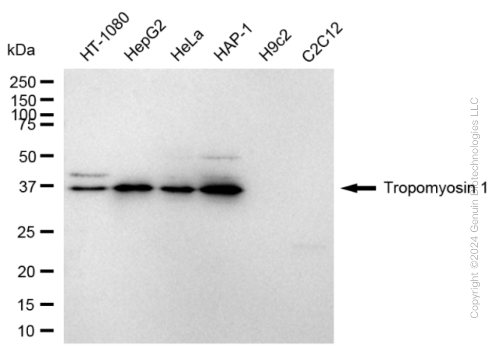 KD-Validated Anti-Tropomyosin 1 Rabbit Monoclonal Antibody ABG1732