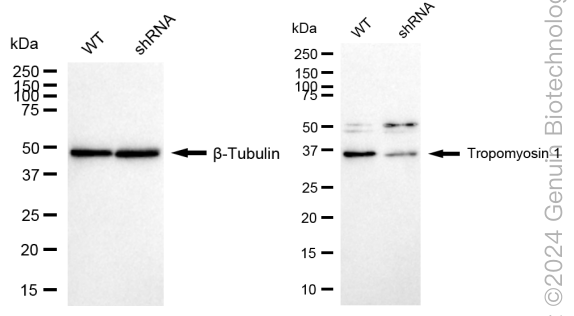 KD-Validated Anti-Tropomyosin 1 Rabbit Monoclonal Antibody ABG1732