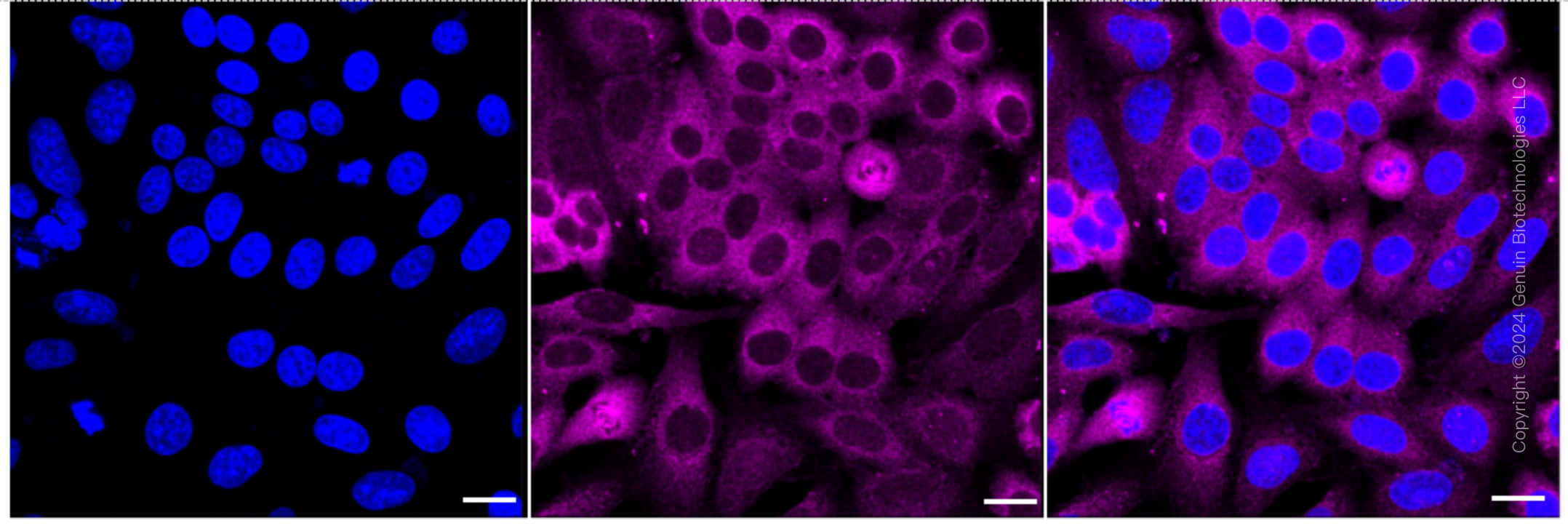 KD-Validated Anti-Sorting Nexin 1 Rabbit Monoclonal Antibody ABG1733