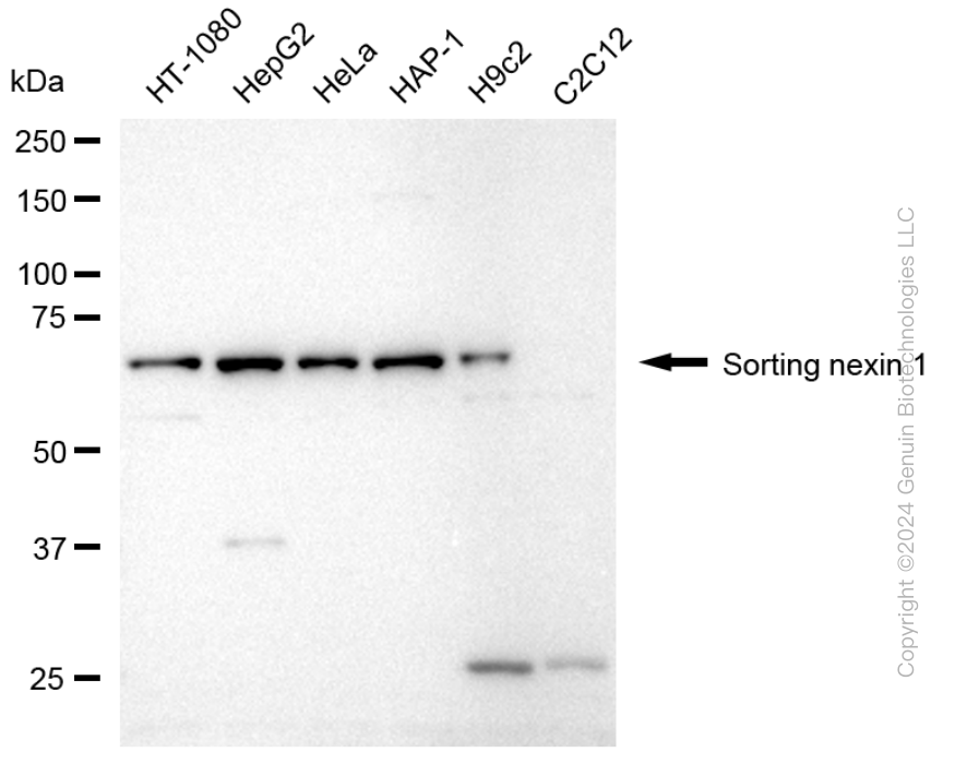 KD-Validated Anti-Sorting Nexin 1 Rabbit Monoclonal Antibody ABG1733