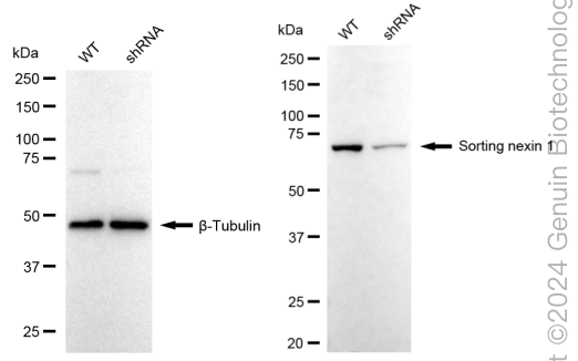 KD-Validated Anti-Sorting Nexin 1 Rabbit Monoclonal Antibody ABG1733