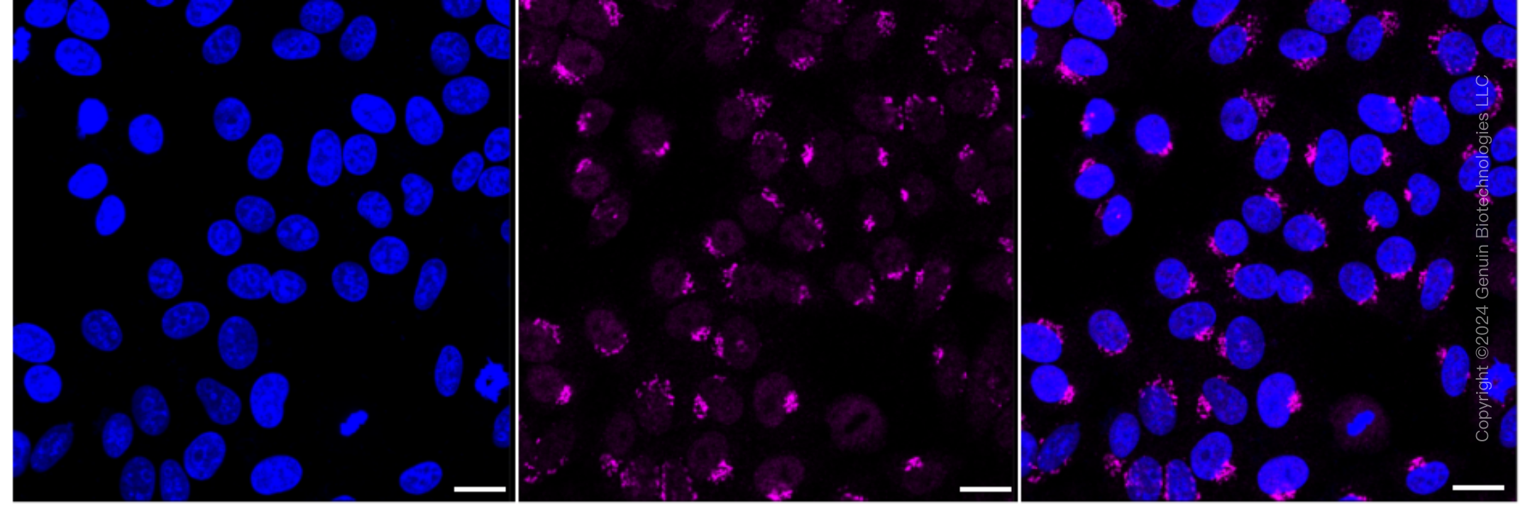 KD-Validated Anti-Somatostatin Receptor 5 Rabbit Monoclonal Antibody ABG1734