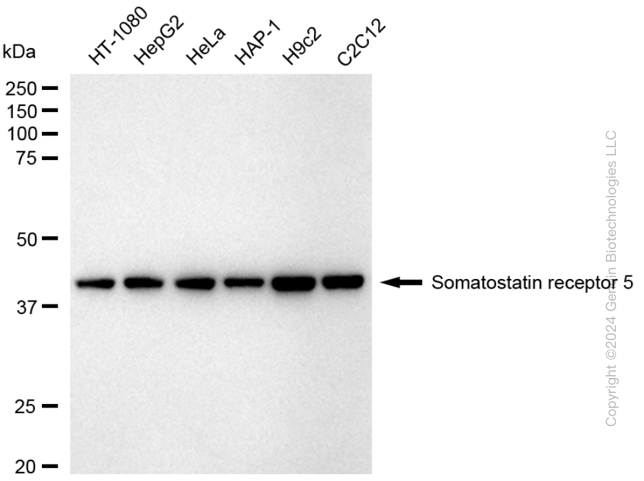 KD-Validated Anti-Somatostatin Receptor 5 Rabbit Monoclonal Antibody ABG1734