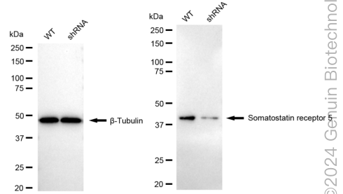 KD-Validated Anti-Somatostatin Receptor 5 Rabbit Monoclonal Antibody ABG1734